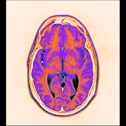 64162533542198579898252916190583583845604629893829087458582976467072133890049