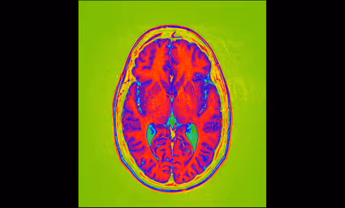 Item #64162533542198579898252916190583583845604629893829087458582976515450645512193 Media