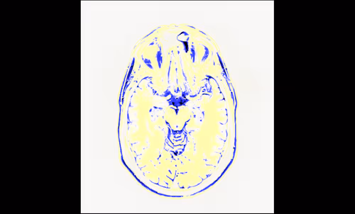 Item #64162533542198579898252916190583583845604629893829087458582976299946366468097 Media