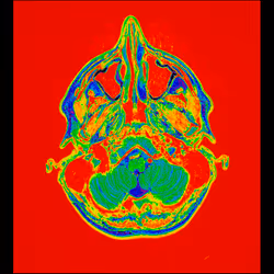 64162533542198579898252916190583583845604629893829087458582975706210087469057