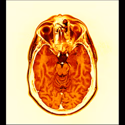 64162533542198579898252916190583583845604629893829087458582976251567854845953