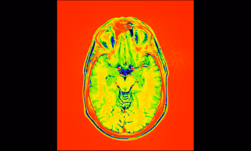 Item #64162533542198579898252916190583583845604629893829087458582976324135622279169 Media