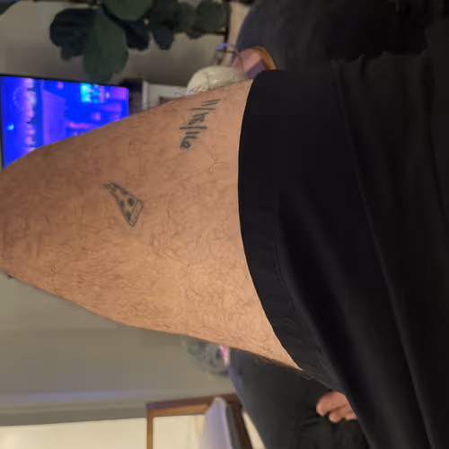 leg