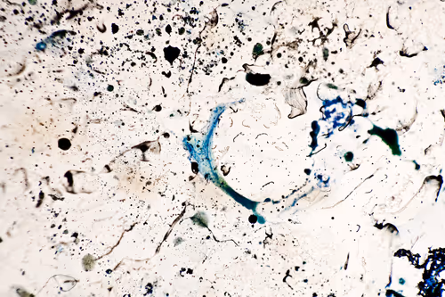 Item #9251341193756129610411101804839683921415719585297066577807806950213635014657 Media