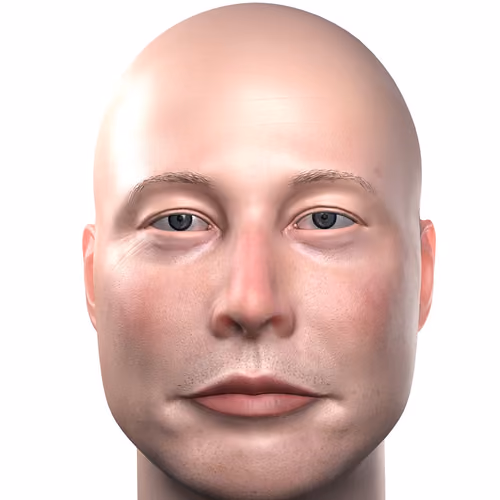 Bald Elon