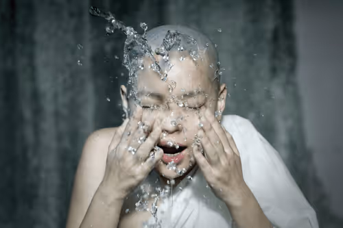 Bald Empathy Movement