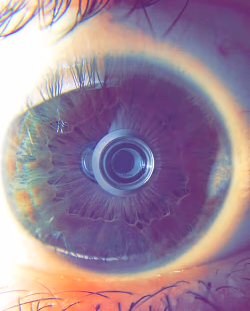 Item #12861062766571801968991002032853861096782041282805726312665843381743715876865 Media