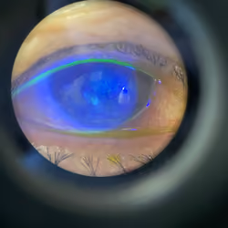 eye in scope