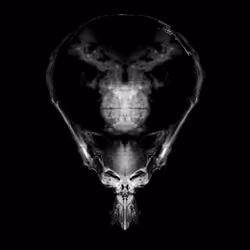 Alien Embryo - 225 of 2000