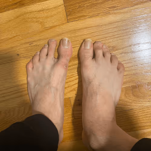 Sisyphus Feet