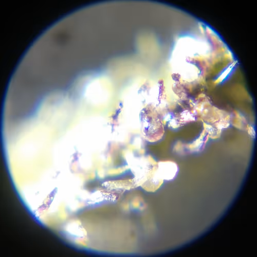 Trichomes #8