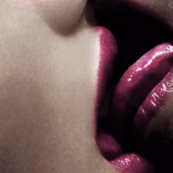 Kiss