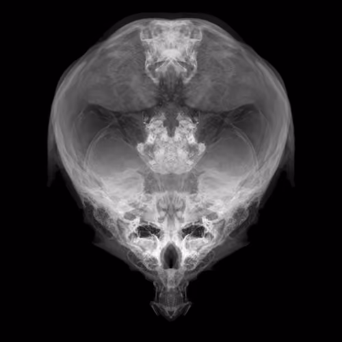 Alien Embryo - 383 of 2000
