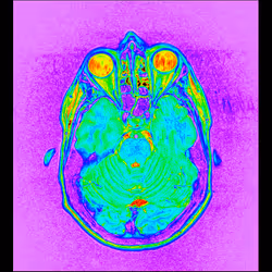 64162533542198579898252916190583583845604629893829087458582976154810831601665