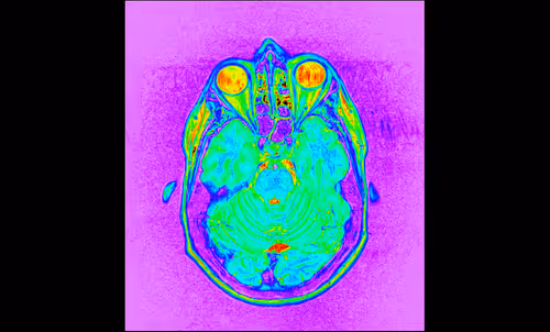 Item #64162533542198579898252916190583583845604629893829087458582976154810831601665 Media