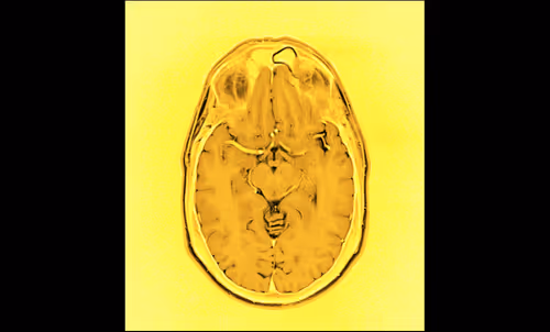 Item #64162533542198579898252916190583583845604629893829087458582976394504366456833 Media