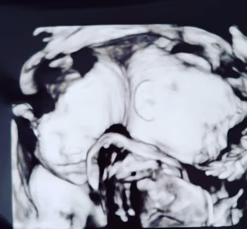 Item #2529133591956882598148239903017273800410949867267906272500891845037060521985 Media