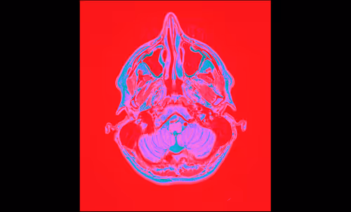 Item #64162533542198579898252916190583583845604629893829087458582975682020831657985 Media