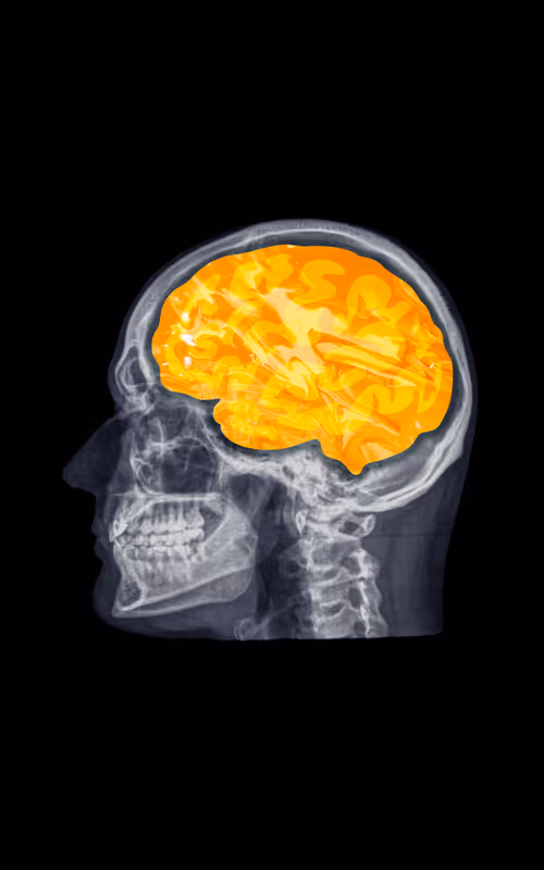 Item #24230885534779484670501703553684953274983737514794072512407783980757071953921 Media