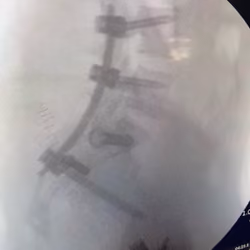 SpinoPelvic Trauma