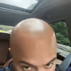 bald rican