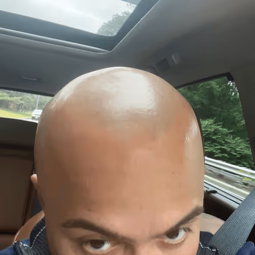 bald rican