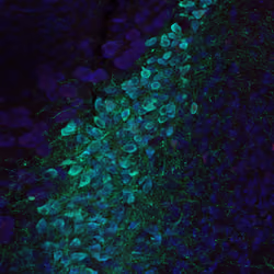 Neurons #19