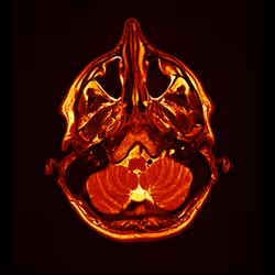 64162533542198579898252916190583583845604629893829087458582975735896901419009