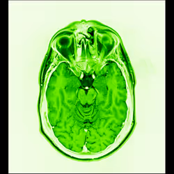 64162533542198579898252916190583583845604629893829087458582976247169808334849