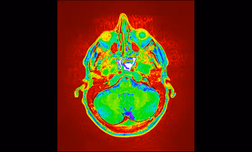 Item #64162533542198579898252916190583583845604629893829087458582975925012901396481 Media