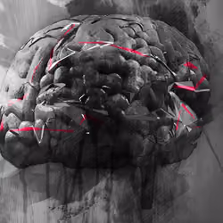 3DMind Brain Side