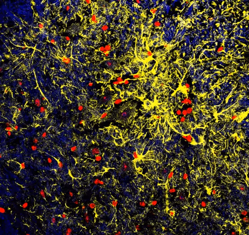 Item #56093845266365580198989074568914204894151473020386784908679452203721435381761 Media