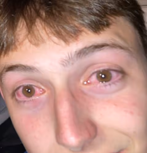 Juul 420 Eyes