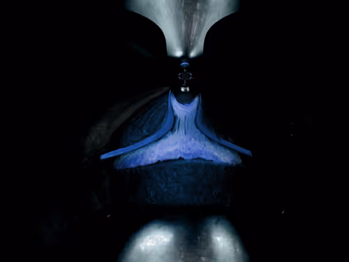 Item #67457553150443021914092587022250176347061355639032054621716076045428561281025 Media