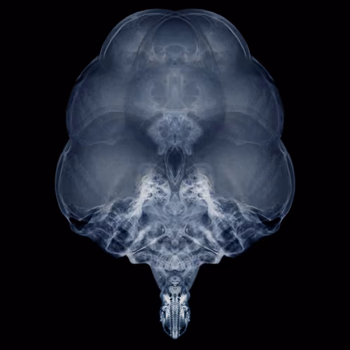 Alien Embryo - 441 of 2000