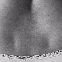 The holes on my back