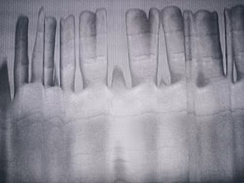 Item #64466523269938500867477772710404376308525041560697885327991816728938356408321 Media