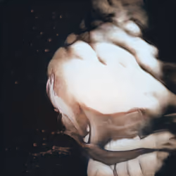 Embrace