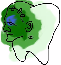 Frankenmolar