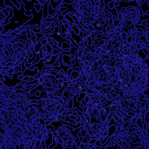 Unraveled 012