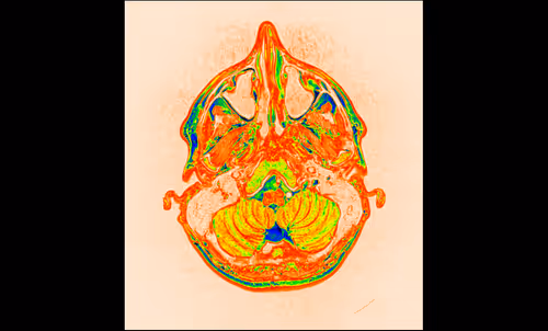 Item #64162533542198579898252916190583583845604629893829087458582975745792506068993 Media