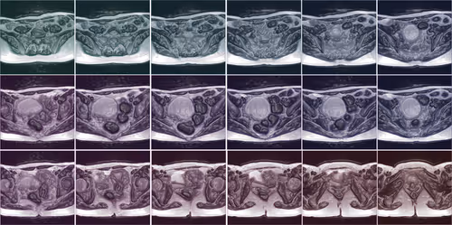 Item #33729904487083342964442328512687567246375750320202692497428806274679855644673 Media