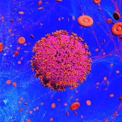 Pandemic Virus Specimen 3423
