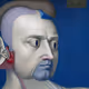 17172