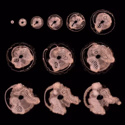 Embryogenesis #76