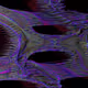 76