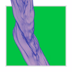 Framed Growth 080