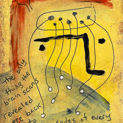 E9art