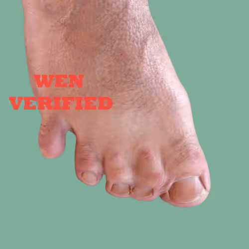 Fungiblefeet