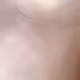 81